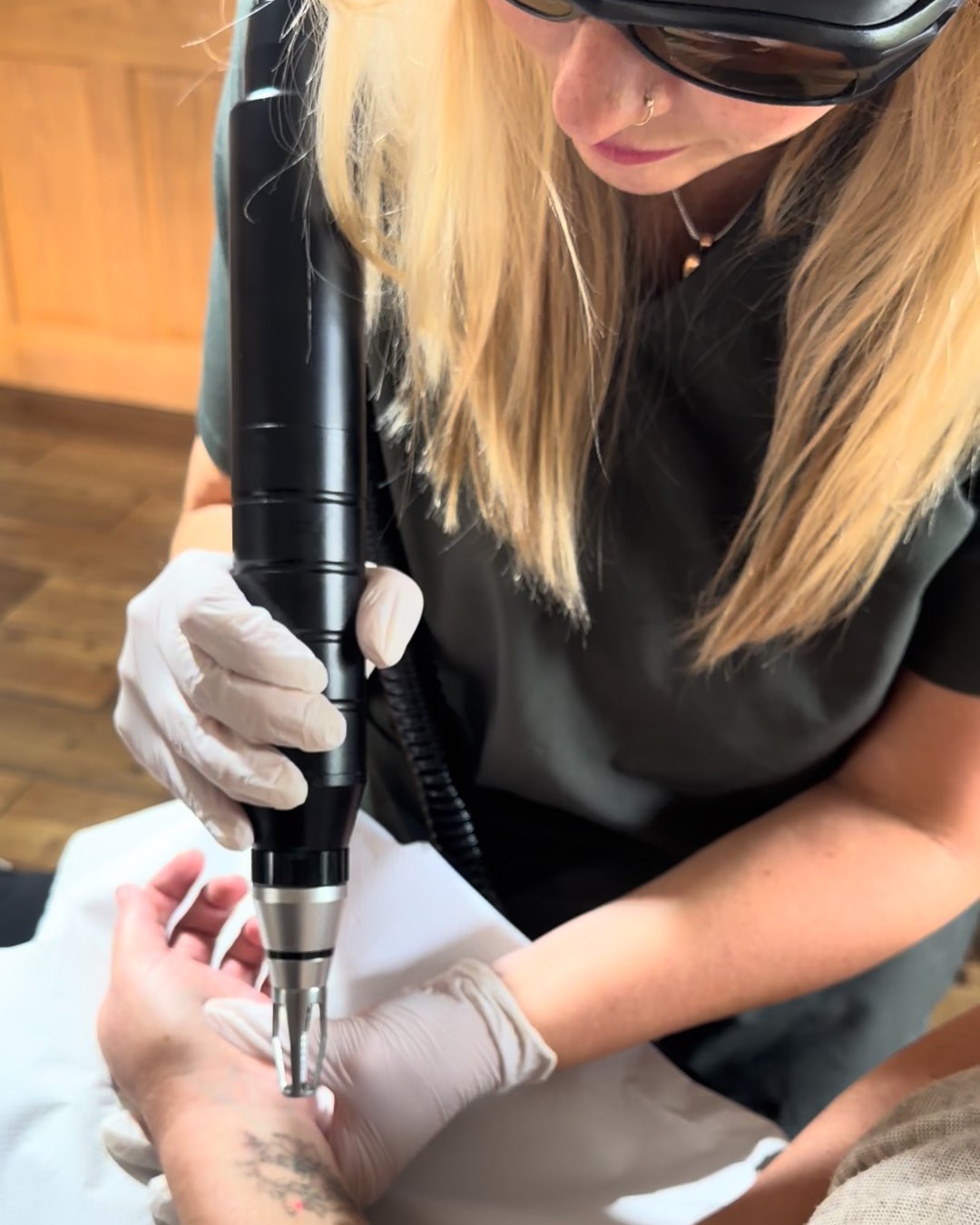 Laser tattoo removal in the treatment room at Glebe Farm: a gloved practitioner in safety glasses holds the laser to a wrist tattoo